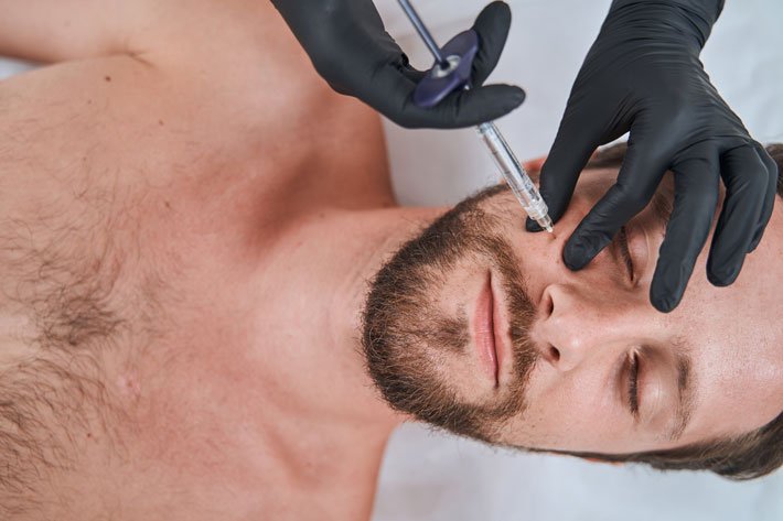 Man getting a dermal fillers lying with his eyes closed during the mesotherapy procedure performed by a certified doctor